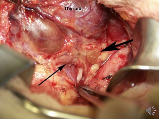 Endocrine Surgery